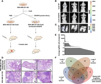 Stabilization of CCDC102B by Loss of RACK1 Through the CMA Pathway Promotes Breast Cancer Metastasis via Activation of the NF-κB Pathway